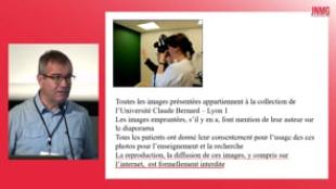 JNMG 2022 - Apport de la dermatoscopie en médecine générale